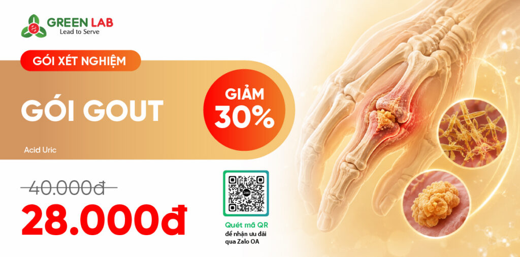 Gói xét nghiệm Gout tại Green Lab: Acid Uric ưu đãi còn 28.000đ
